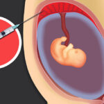 What is a chorionic villus sampling test?