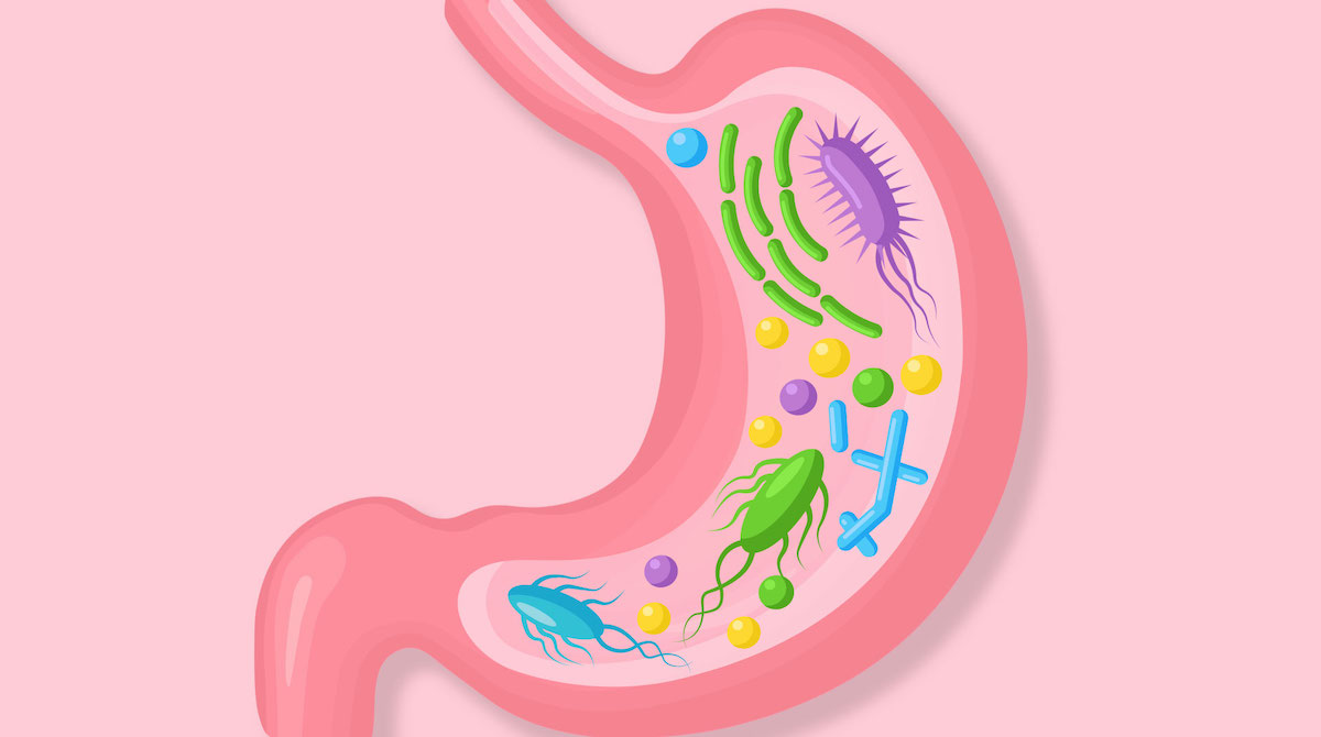 How to improve gut health and 12 foods that are good for the intestines