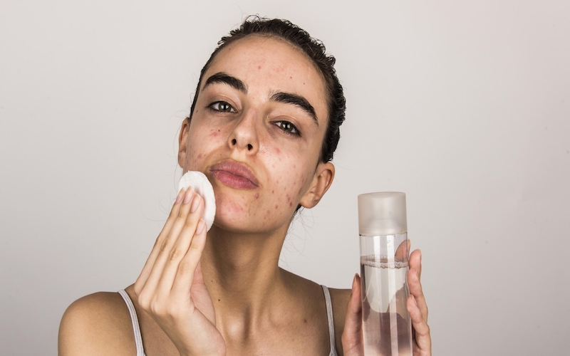 Revealing an effective facial care routine for acne at home