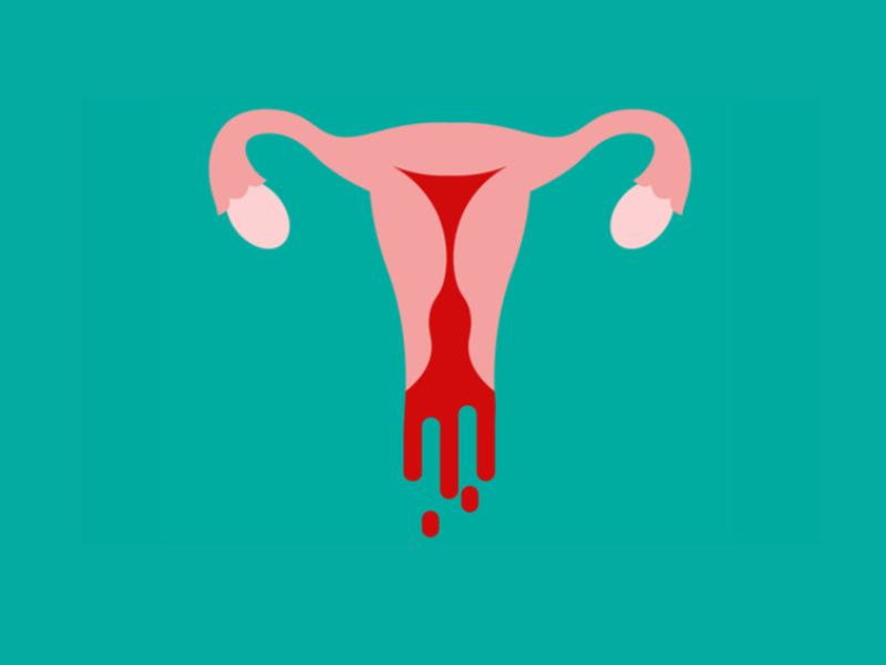 Vaginal bleeding