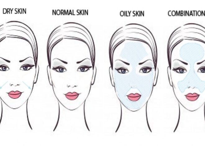 Which Skin Type Are You? Top 4 most popular skin types