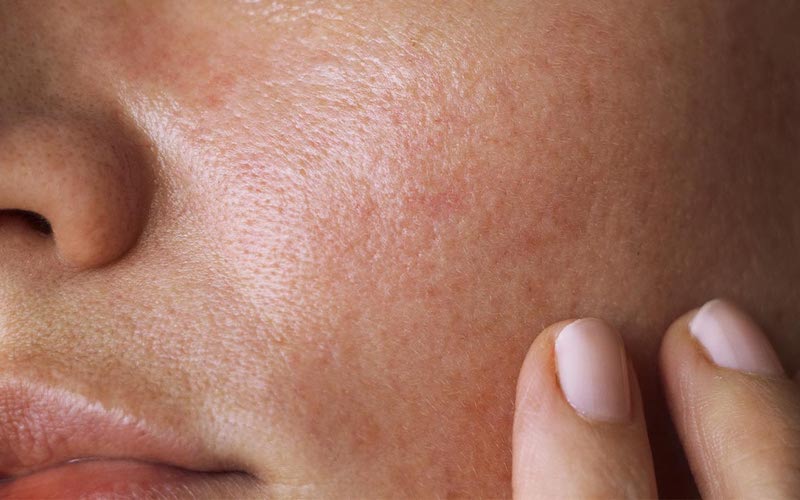 What products make oily skin worse?