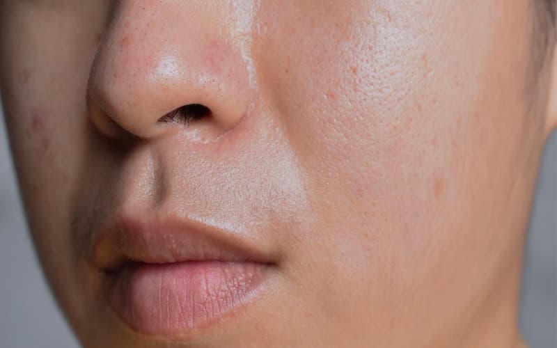 What products make oily skin worse?