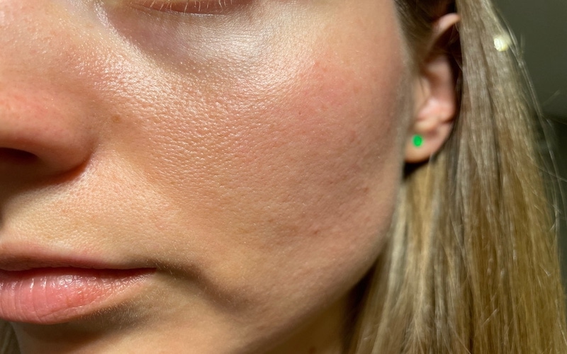 Why is your skin oily?